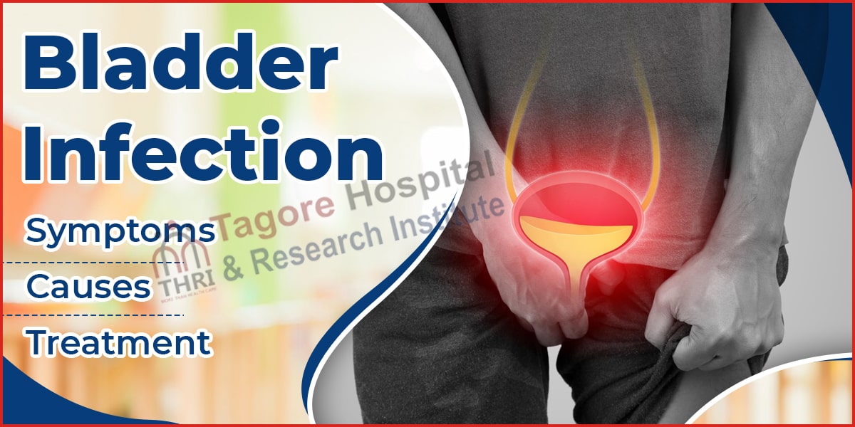 Bladder Infection: Symptoms, Causes & Treatment