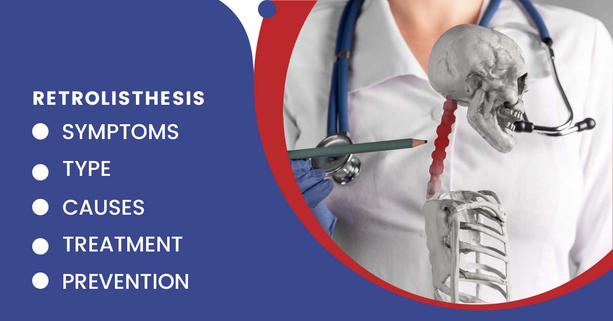 Retrolisthesis: Types, Symptoms, Causes, Treatment, and Prevention